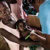 The nutrition situation of children under the age of five years in Malawi is fragile.jpg